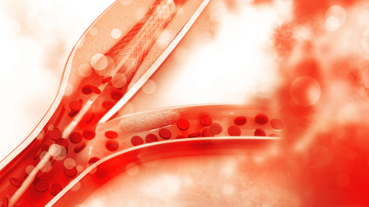 Comment diminuer les risques de l’athérosclérose sur la santé ?