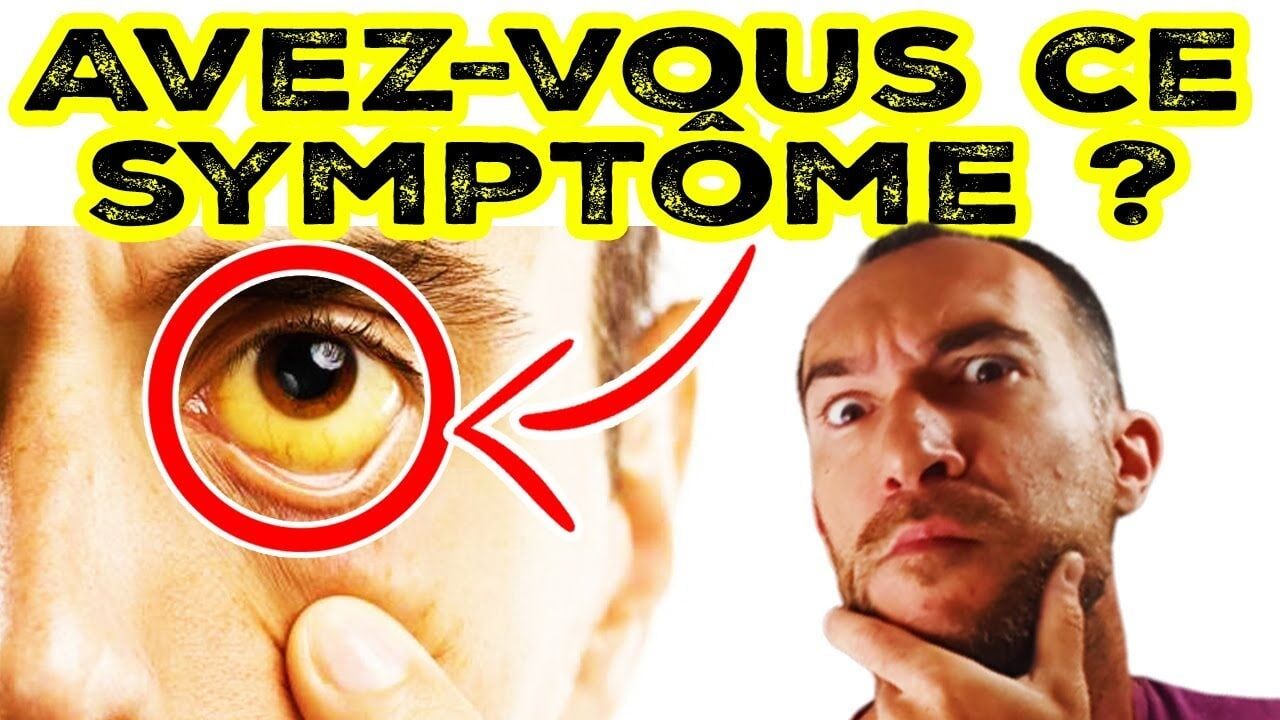 7 SIGNES surprenants que votre FOIE est MALADE !