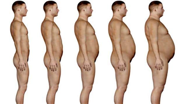 obesité chez l'homme